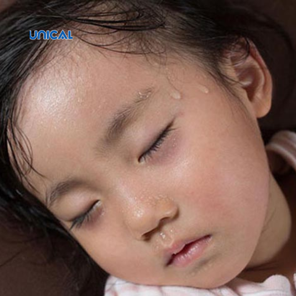 Các bé bị thiếu canxi thường hay đổ mồ hôi trộm