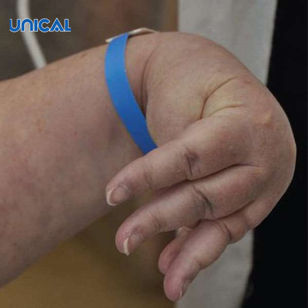 Dấu Trousseau là dấu hiệu điển hình của hạ canxi máu