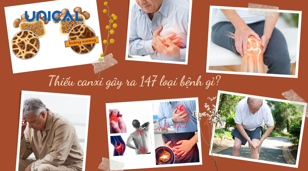 Thiếu canxi gây ra 147 bệnh gì