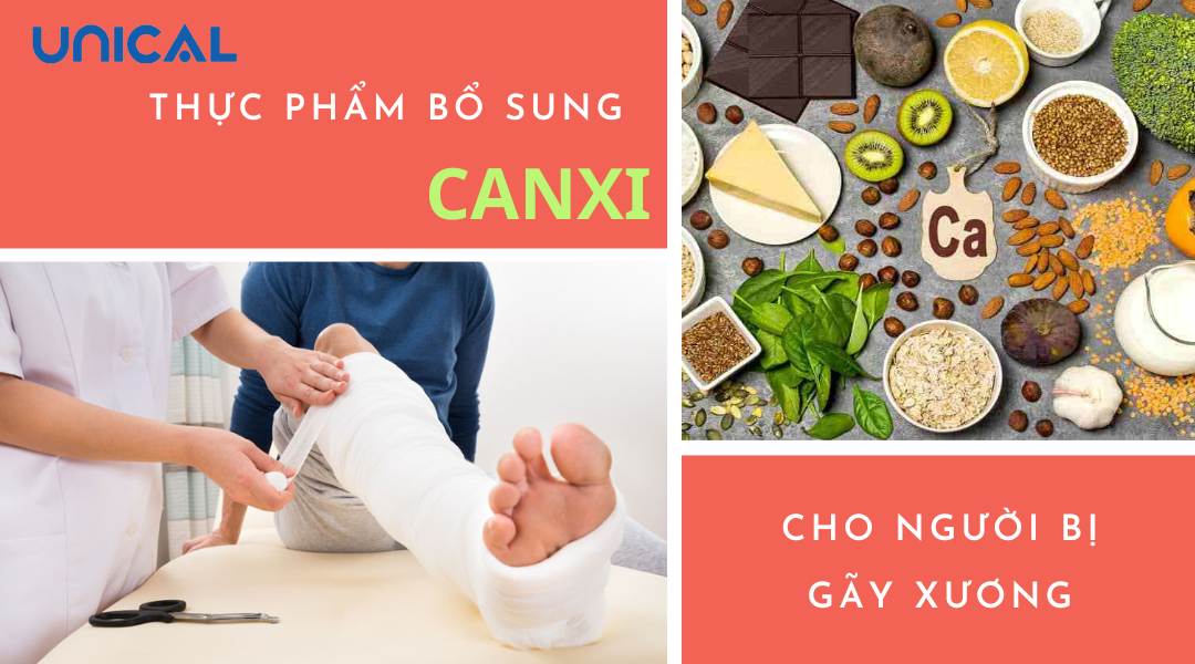 Tổng hợp những thực phẩm bổ sung canxi cho người gãy xương