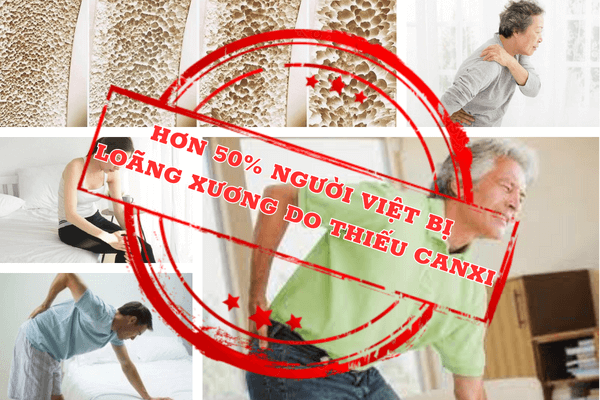 phiếu đo canxi miễn phí