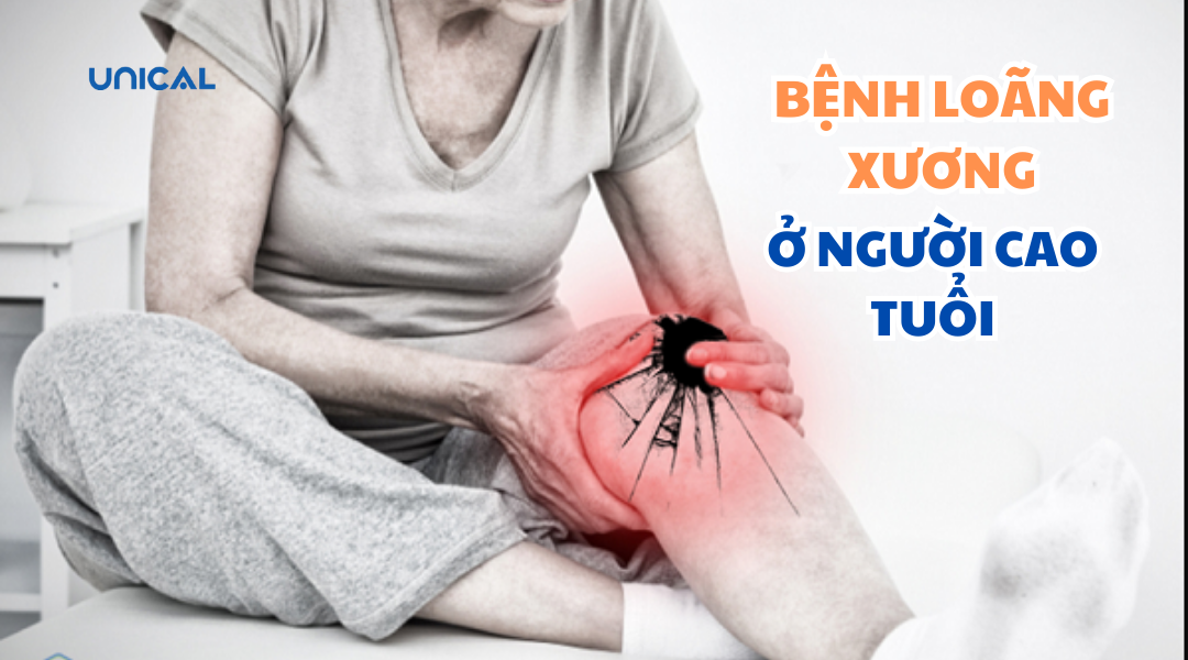 [TÌM HIỂU] Bệnh loãng xương ở người cao tuổi