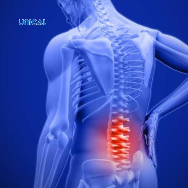 Đau lưng là một trong những biểu hiện loãng xương