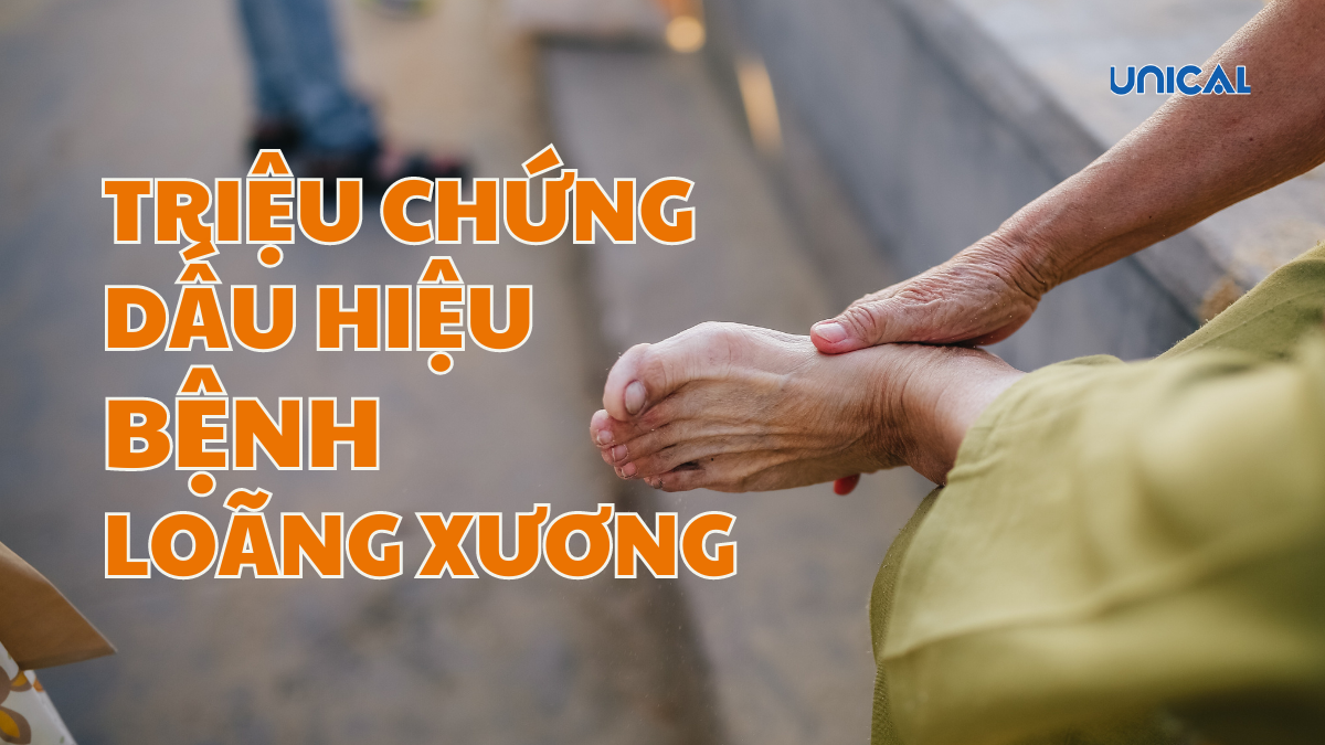 Dấu hiệu loãng xương