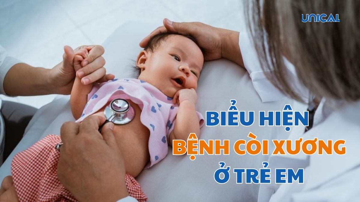 biểu hiện bệnh còi xương ở trẻ em